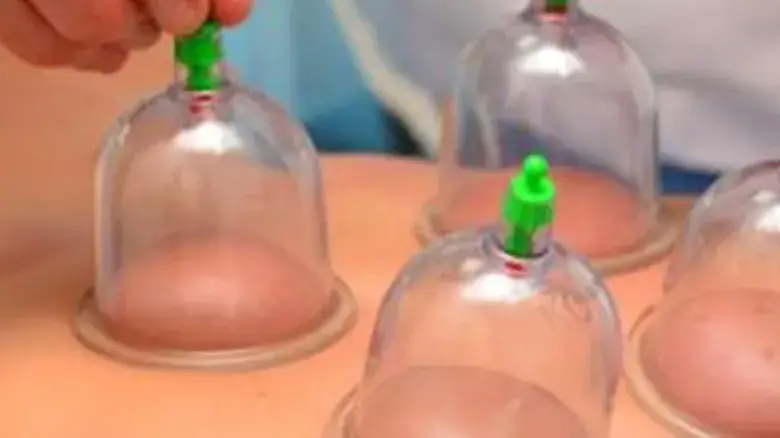 مساج كاسات الهواء